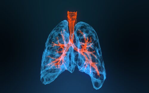 3d rendered illustration of lung cancer